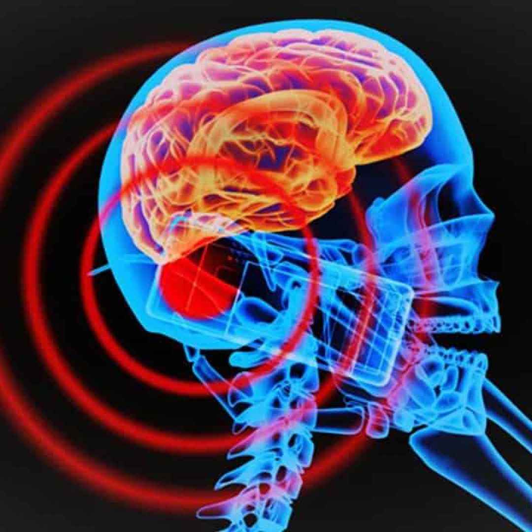 Gli smartphone fanno venire il tumore al cervello la